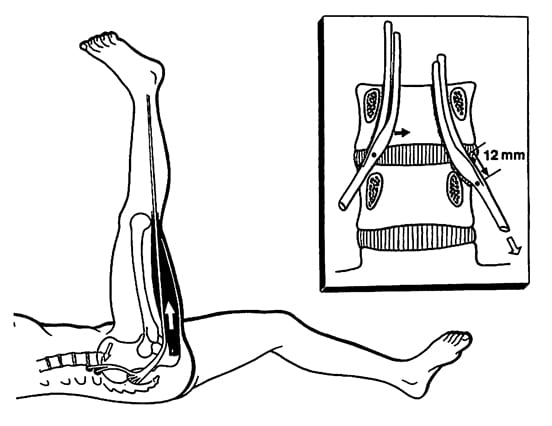 figure drawing – stretch & compress