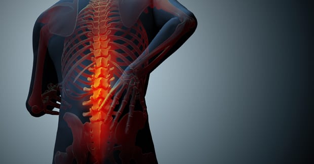 El Problema de un Problema de Dolor Lumbar