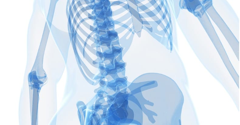 Low Back Pain: Spondylolisthesis