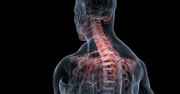 Neck & Back Pain Diagnosis