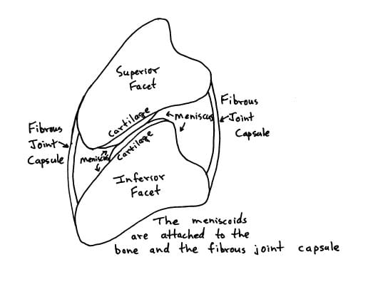 Meniscoids may become entrapped between the articular cartilages of the facet joints. This causes pain, spasm, reduced movement, and “an acute locked neck syndrome.” “Spinal adjusting can solve the problem by separating the apposed articular cartilages and releasing the trapped apex.”