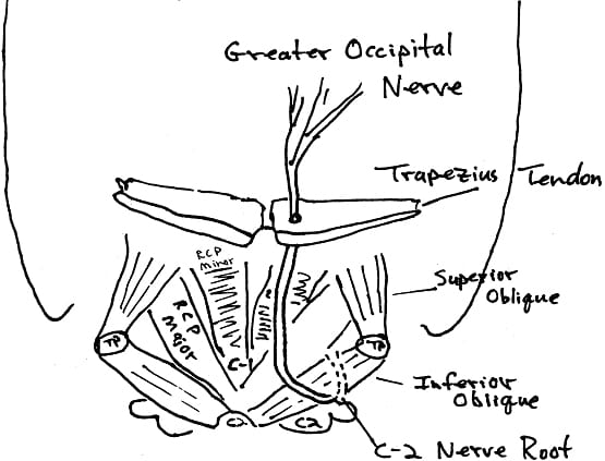  The 2nd cervical nerve root becomes the greater occipital nerve as it pierces the tendon of the trapezius muscle.