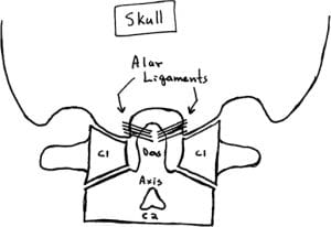 Whiplash Trauma, Alar Ligament Injury, and Chronic Neck Pain