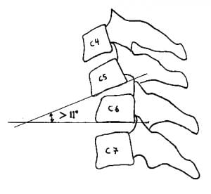 Cervical Spine Injury and Clinical Instability