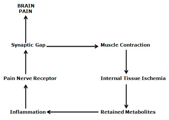  “pain-muscle-pain” cycle.