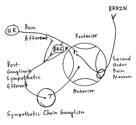 post-ganglionic sympathetic efferents production and release of the catecholamine norepinephrine to receptors located on the nociceptive afferent axons and dorsal root ganglions 