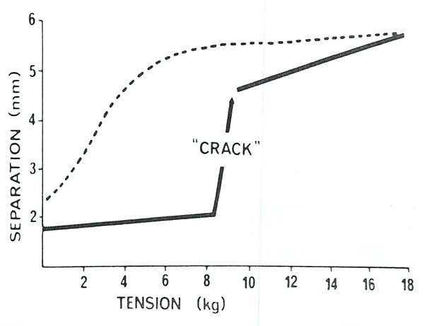 Cracking in the Metacarpal-Phalangeal Joint