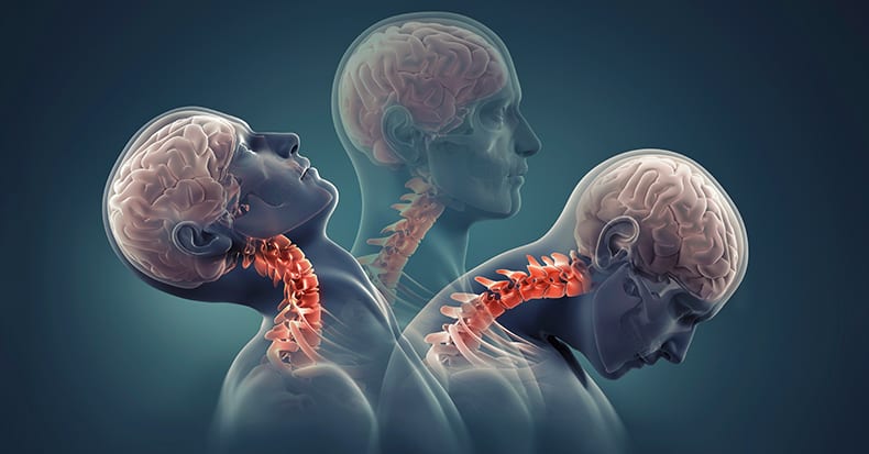 Neck Pain Prevention Tips