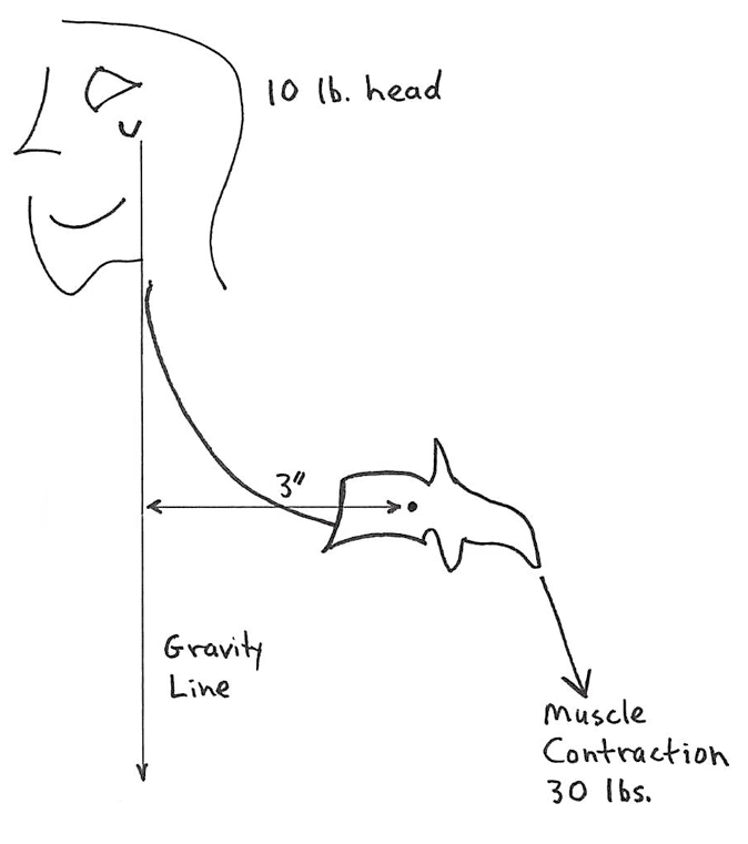 Rene Cailliet, MD, uses an example where a patient has unbalanced forward head posture (1). Dr. Cailliet assigns the head a weight of 10 lbs. and displaces the head’s center of gravity forward by 3 inches. The required counter balancing muscle contraction on the opposite side of the fulcrum (the vertebrae) would be 30 lbs. (10 lbs. X 3 inches):