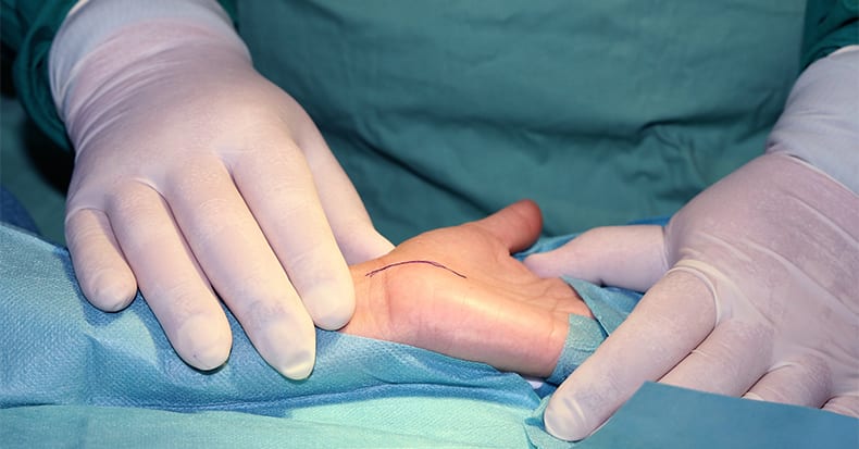 WHEN Is Surgery Needed for Carpal Tunnel Syndrome?