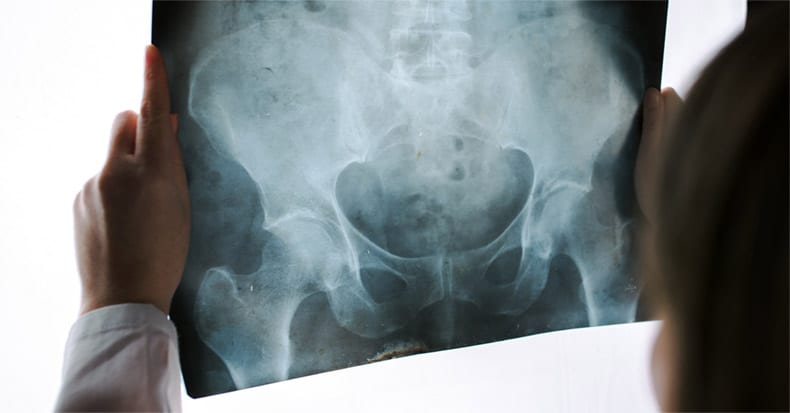 Common Hip Injuries