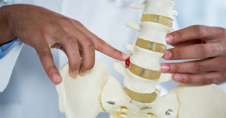 ¿Qué causa el dolor lumbar?