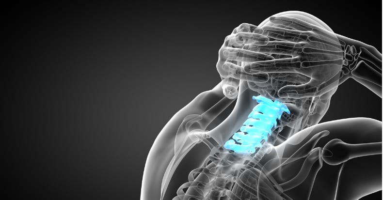 Neck Pain – What Is Cervical Spinal Stenosis? - Woodward