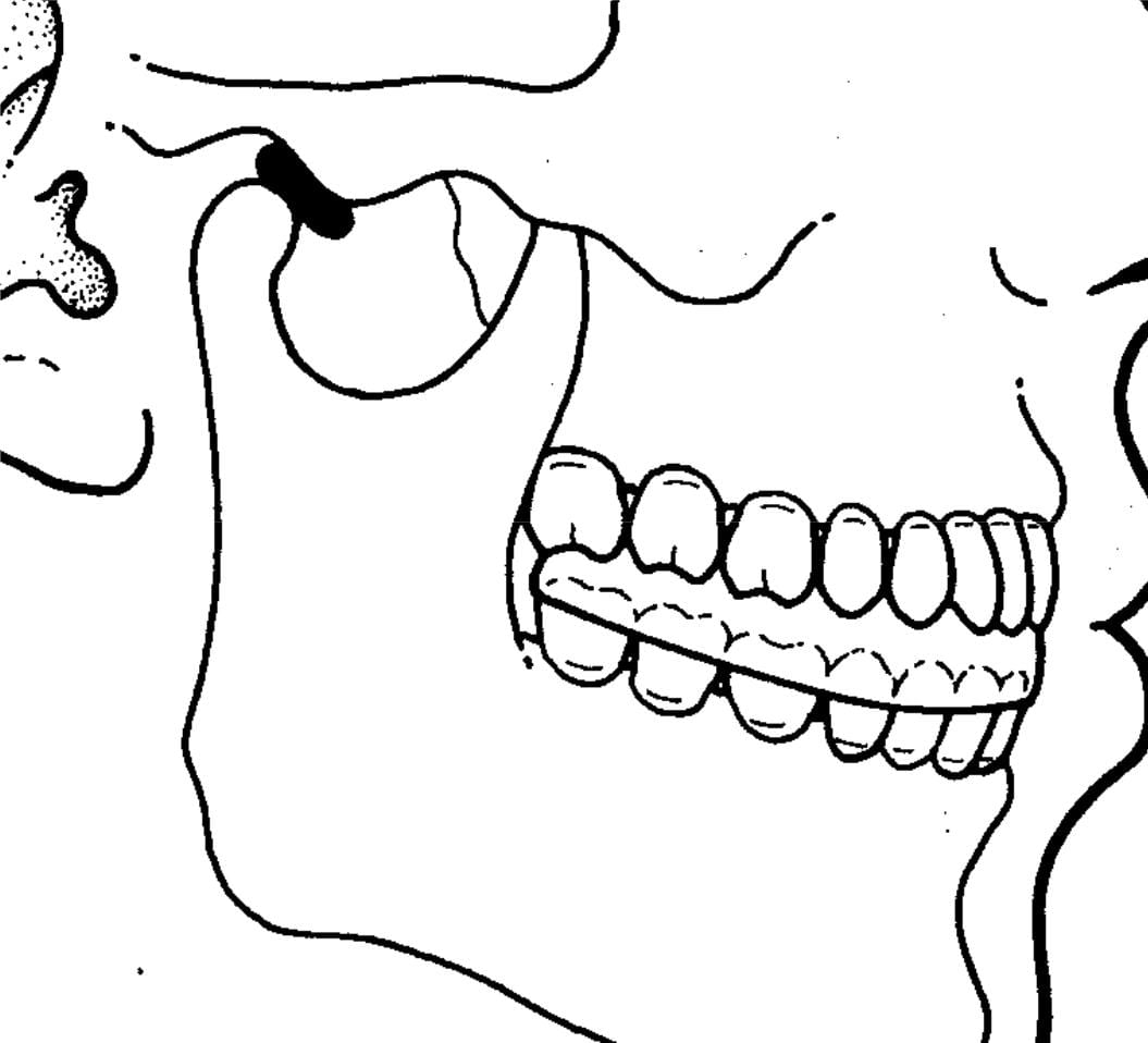 Temporomandibular Joint Disorders, the Cervical Spine, and Spinal