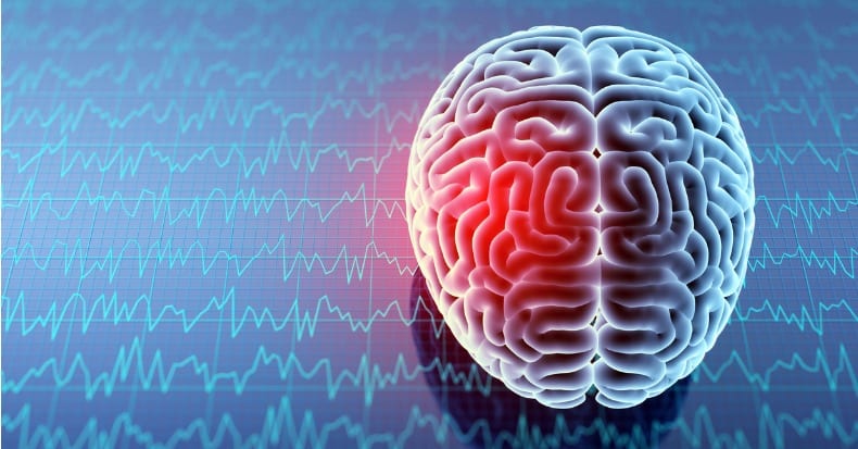 Como Cambia el Cerebro Después del Latigazo Cervical