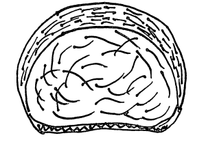 Axial View Cervical Disc Viewed From Above