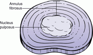 The nucleus pulposus (“nucleus”) is at the center of the disc. The nucleus is mostly water and functions as a ball-bearing, allowing the vertebrae to bend and twist. The annulus fibrosis (“annulus”) surrounds the nucleus. The annulus fibers are tough, dense, and strong. The annulus fibers surround the nucleus