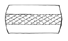  Crisscross Annular Fibers of the Intervertebral Disc