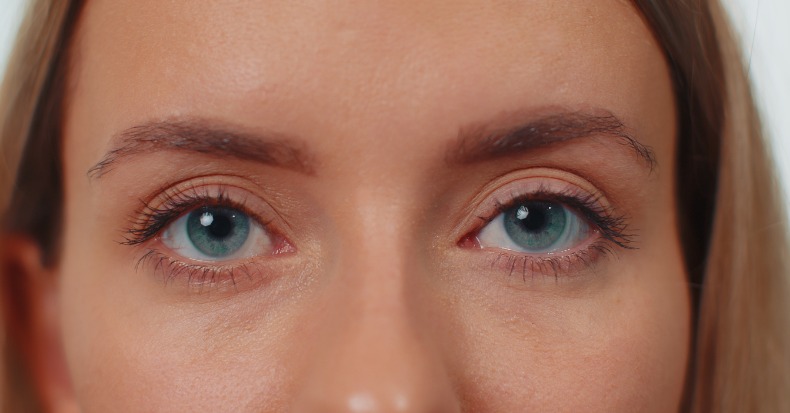 Ejercicios Oculares para el Paciente con Latigazo Cervical