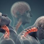 Illustration showing neck movement during whiplash injury with highlighted cervical spine.